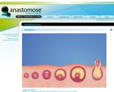 Anastomose Communication